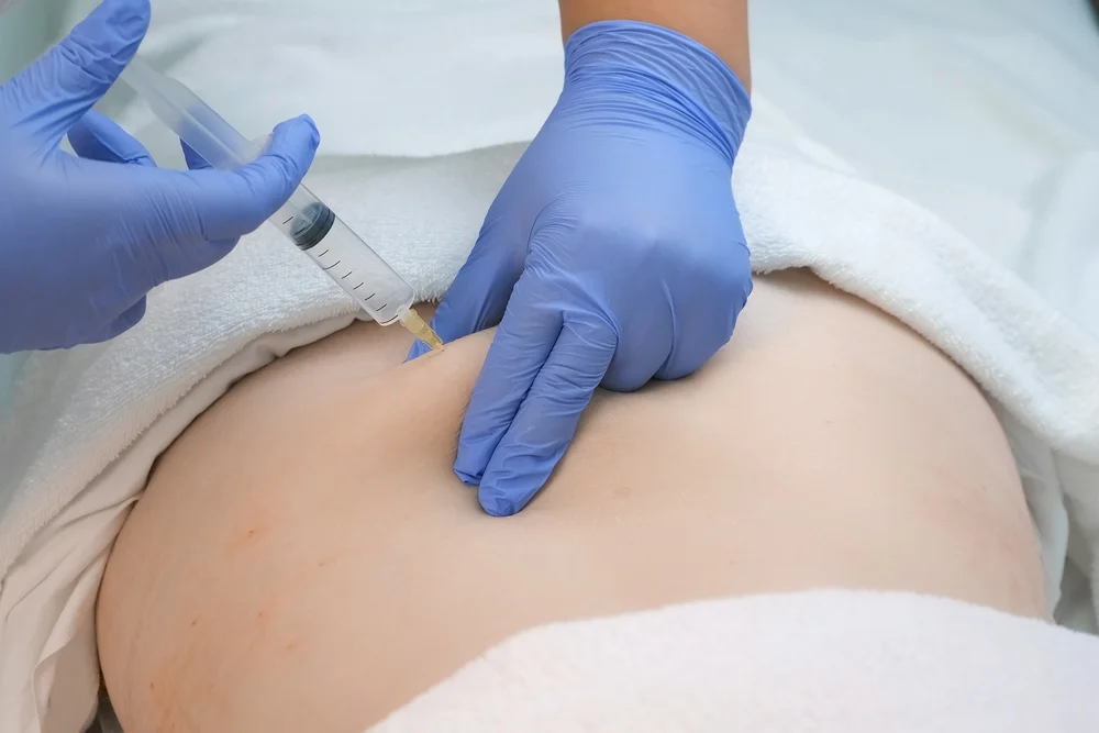 اوزون تراپی کمر